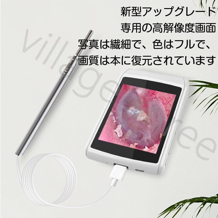 耳鏡 導いた光ファイバー密集可能な医療耳内視鏡ボアスコープ耳のケアヘルスチェック直接耳鏡ツール 洗練された質感のスキッドプルーフグルーブハンドル Color : GREY 耳鏡 導いた光ファイバー密集可能な医療耳内視鏡ボアスコープ耳のケアヘルスチェック直接耳鏡ツール 洗練された質感のスキッドプルーフグルーブハンドル Color : GREY
