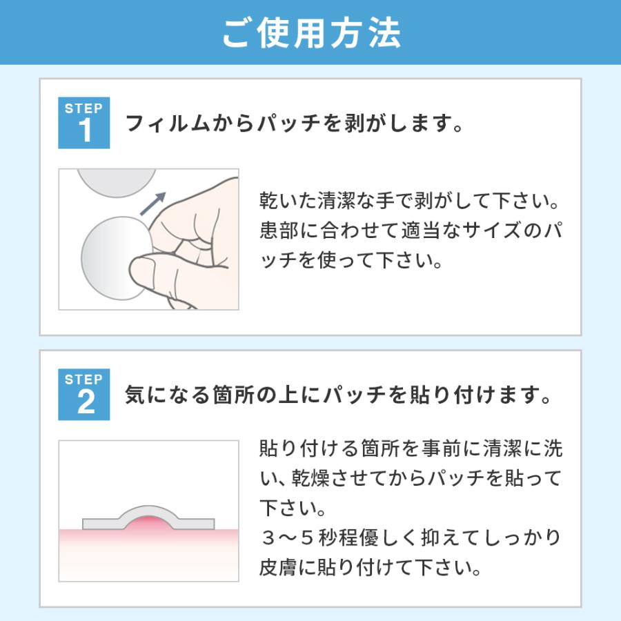 4年保証 ニキビパッチ 28枚入り 一般医療機器 Menon ニキビ 薬 ニキビ跡 にきび 跡 ニキビケア スポットエイド 洗顔 化粧水 クレーター にきびぱっち よく効く860円 Aynaelda Com