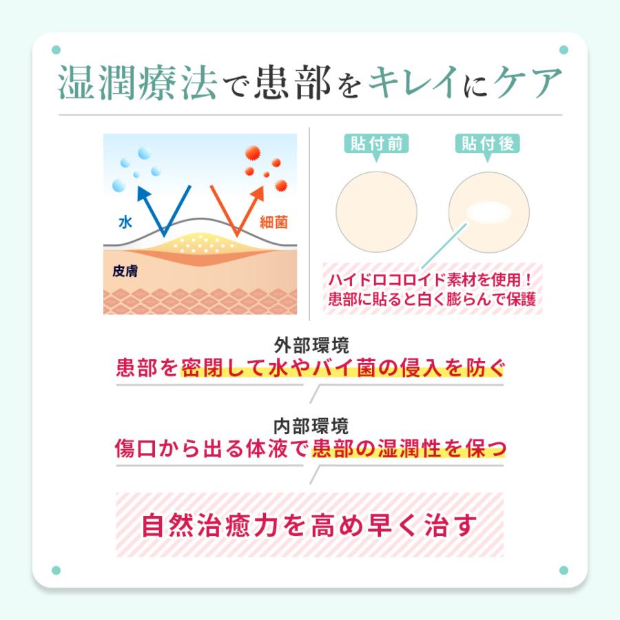 シカ Cica マイクロニードル マイクロパッチ ニードルパッチ Ac 9枚入 ニキビパッチ ニキビケア ポイントパッチ シート マスク 針パック 注入 ポイント パック スポット ニキビ パッチ 肌 トラブル 肌荒れ 鎮静 ツボクサ 保湿 セール 登場から人気沸騰 216点 目に見え