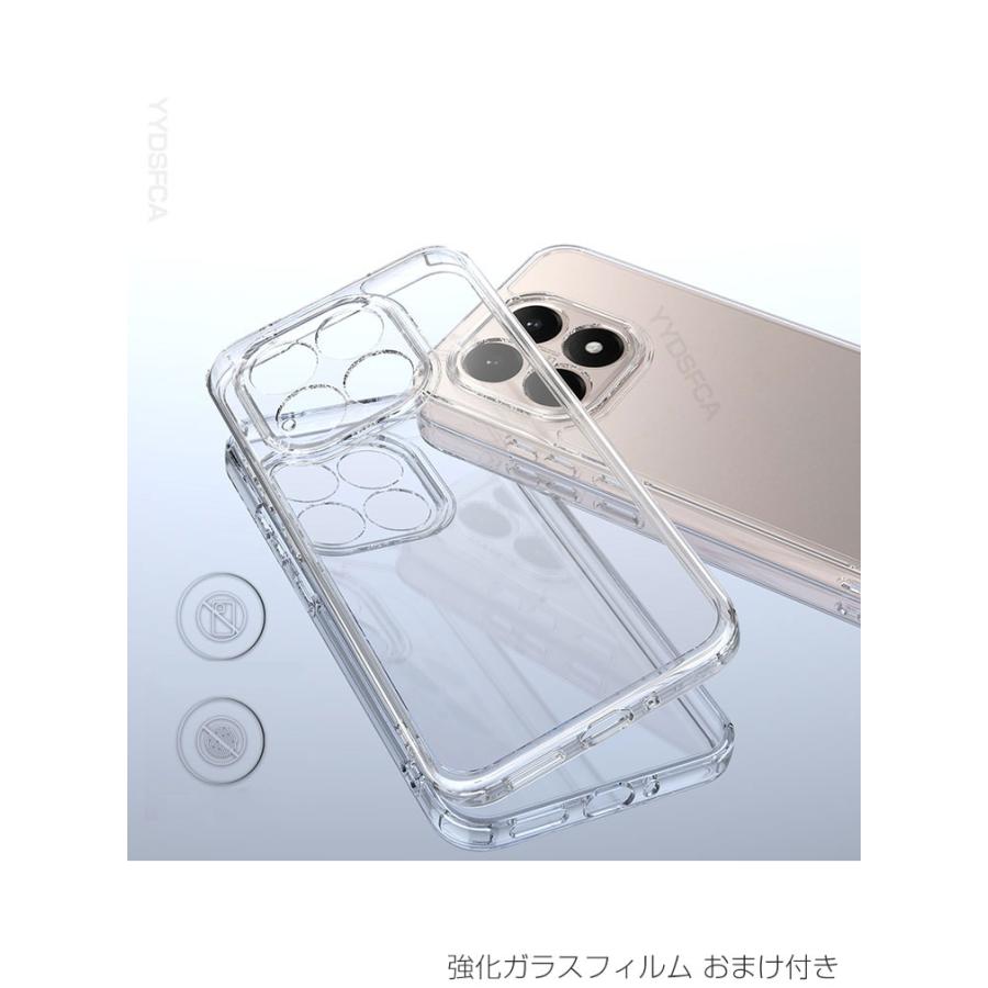 Xiaomi（シャオミ） Xiaomi 15T ケース クリア Xiaomi 15T Pro ケース