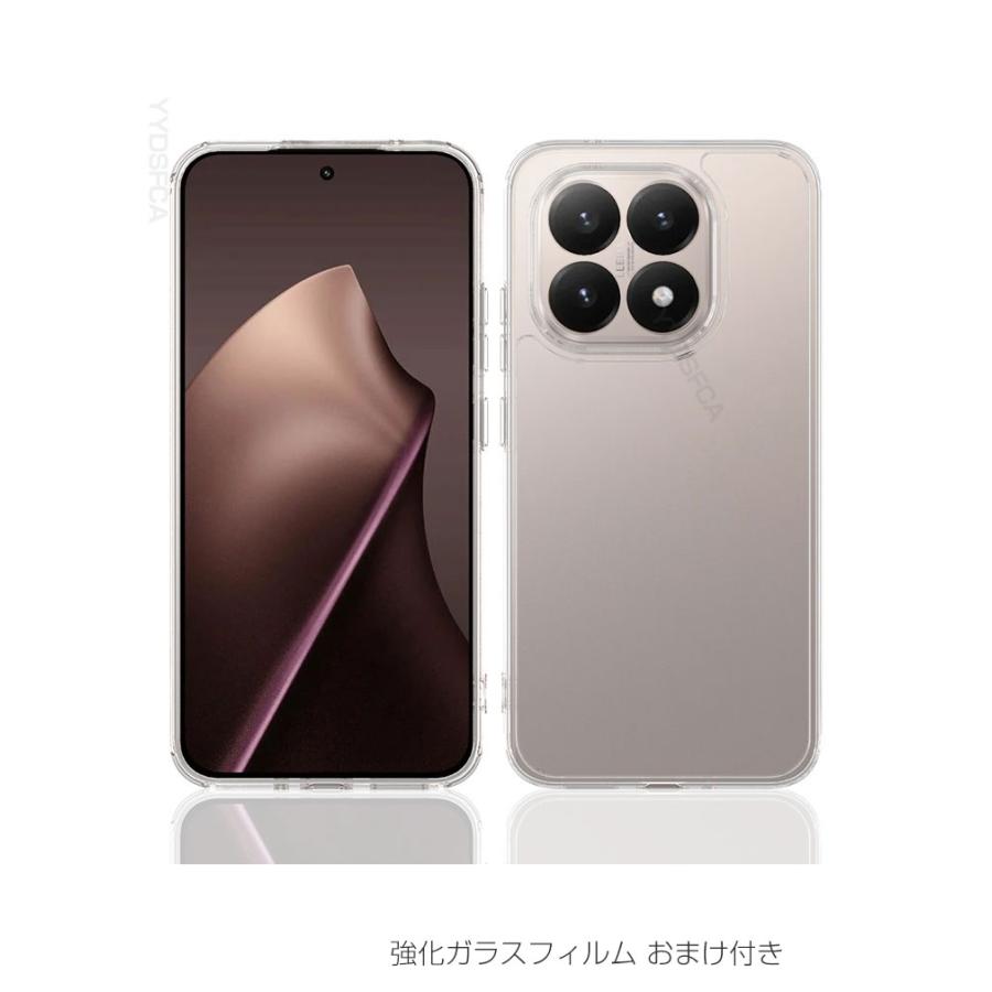 Xiaomi（シャオミ） Xiaomi 15T ケース クリア Xiaomi 15T Pro ケース