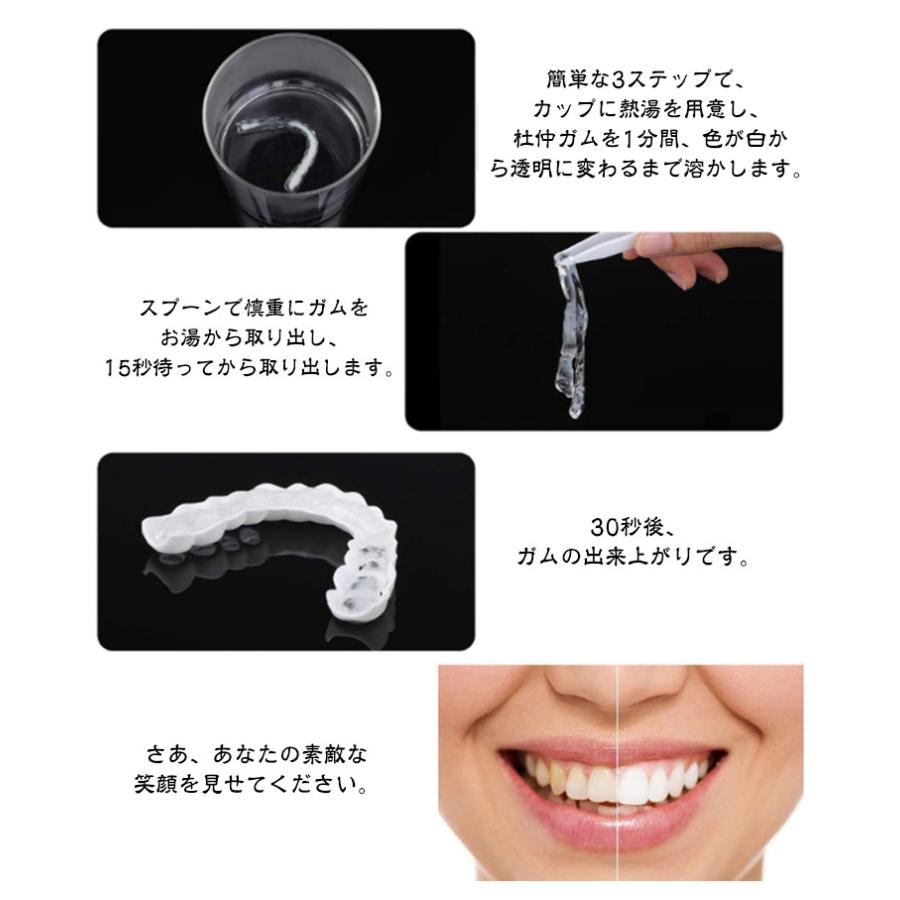 上下セット カバー 義歯 すきっ歯 歯にかぶせる お手軽 白い歯 黄ばみ 
