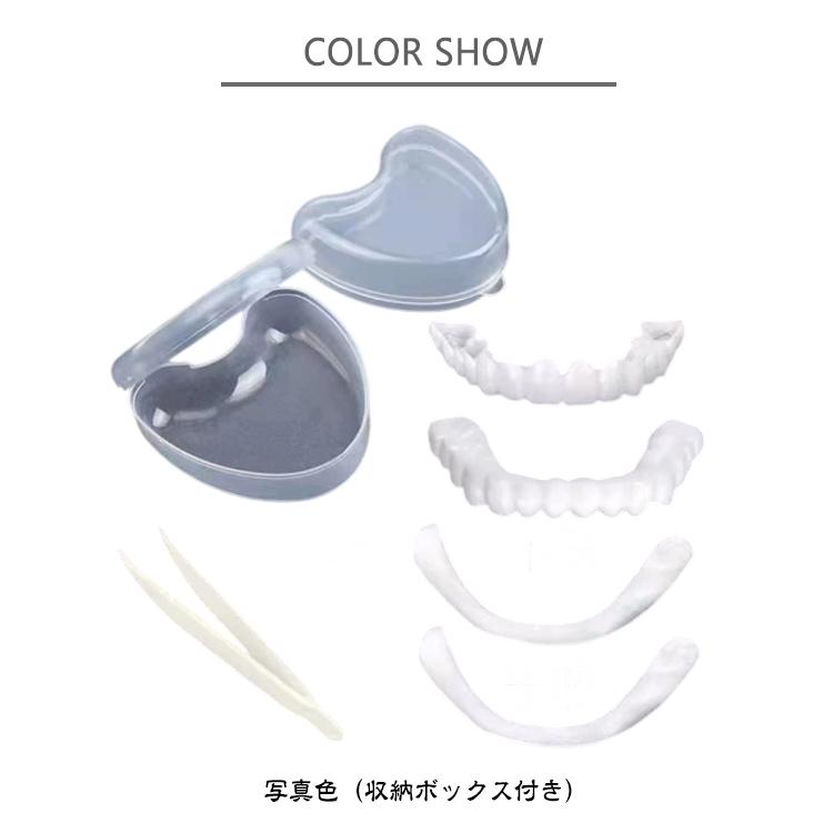 上下セット カバー 義歯 すきっ歯 歯にかぶせる お手軽 白い歯 黄ばみ