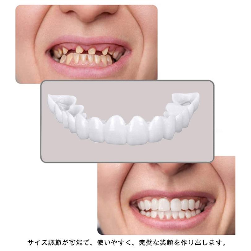 上下セット カバー 義歯 すきっ歯 歯にかぶせる お手軽 白い歯 黄ばみ