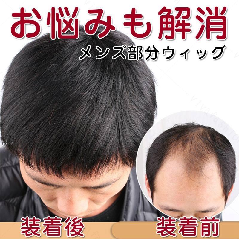 部分ウィッグ かつら ウィッグ 自然 トップピース 人毛 部分かつら ちょこっと増毛 メンズ タイムセール 白髪隠し 人気