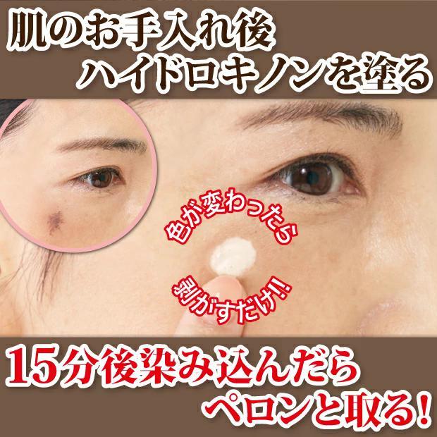 シミ シミ取りクリーム ハイドロキノン シミ取り 男性用 シミ消し 美容
