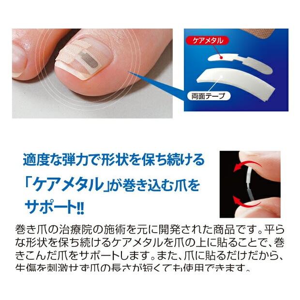 4セット 巻き爪矯正 器具 ワイヤー セット 巻き爪テープ 巻き爪