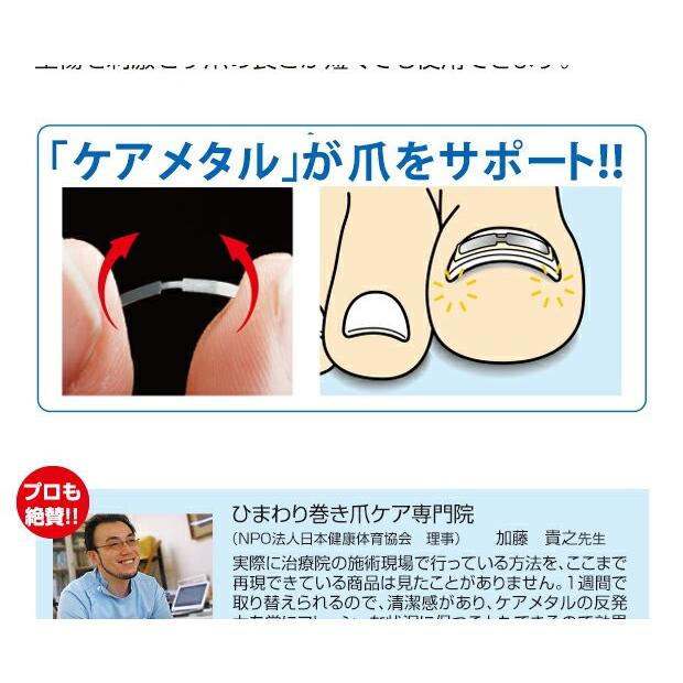 巻き爪矯正 器具 ワイヤー セット 巻き爪テープ 巻き爪クリップ