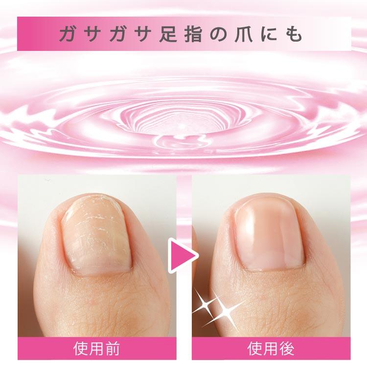 爪 補修 補修液 補強 割れ 保護 おすすめ ネイル 補修剤 ネイルケア クリーム オイル 甘皮ケア 美容液 Md ヴィヴィアン マルシェ 通販 Yahoo ショッピング