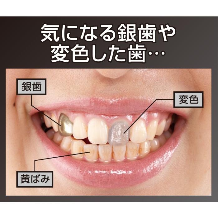 ３セット 歯 マニキュア マニュキア マニュキュア ホワイトニング  自宅 おすすめ 銀歯 歯を白くする 簡単 白 美白 白く 塗る ホワイト 白くする セルフ｜vivian87｜02