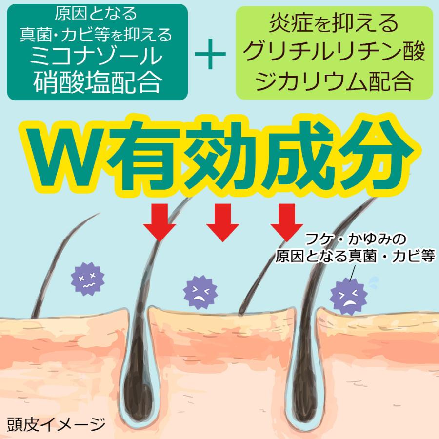 フケ シャンプー ココデオード リンスinシャンプー 詰替え 1000ｍL×5個 フケ 防ぐシャンプー 薬用 かゆみ ミコナゾール硝酸塩 ミコナゾールシャンプー_4