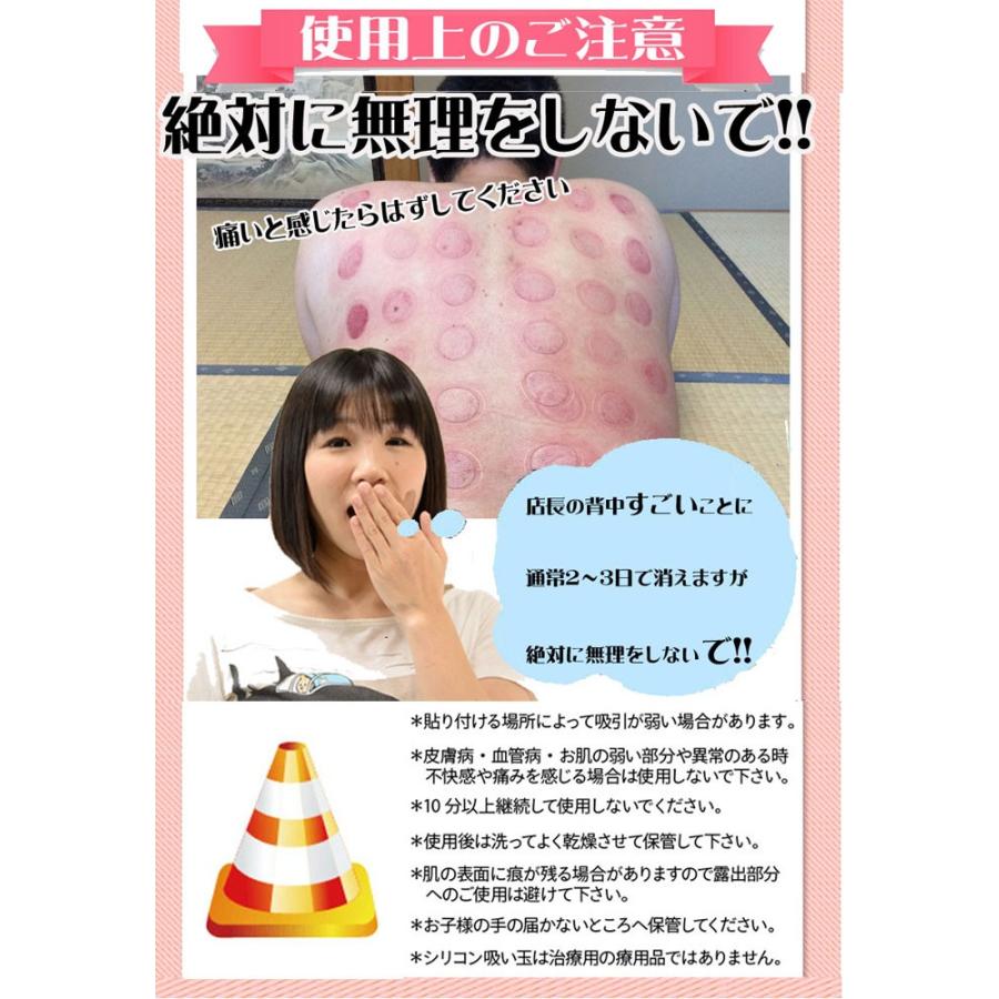 カッピング吸い玉　新品未使用　30個いり Amazon.co.jp: 超ミニミニ吸い玉 6個セット シリコン製