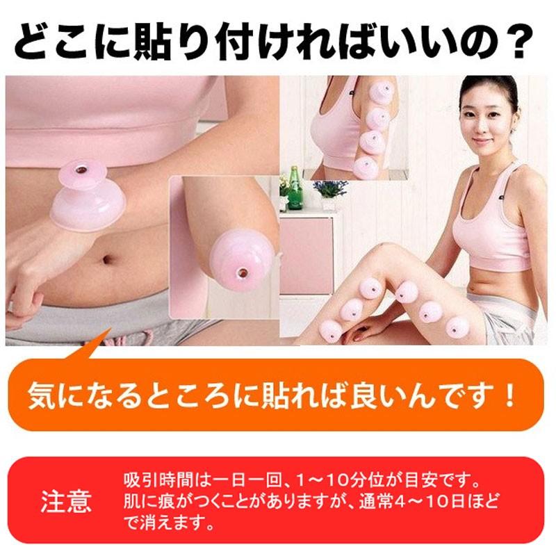 吸い玉カップ　カッピング　17個入り カッピング 吸い玉 シリコン製カッピング 8個セット ソフト
