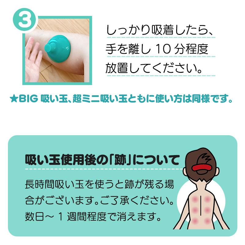 高級カッピングセット 手のひらより大きい超巨大シリコン製吸い玉+