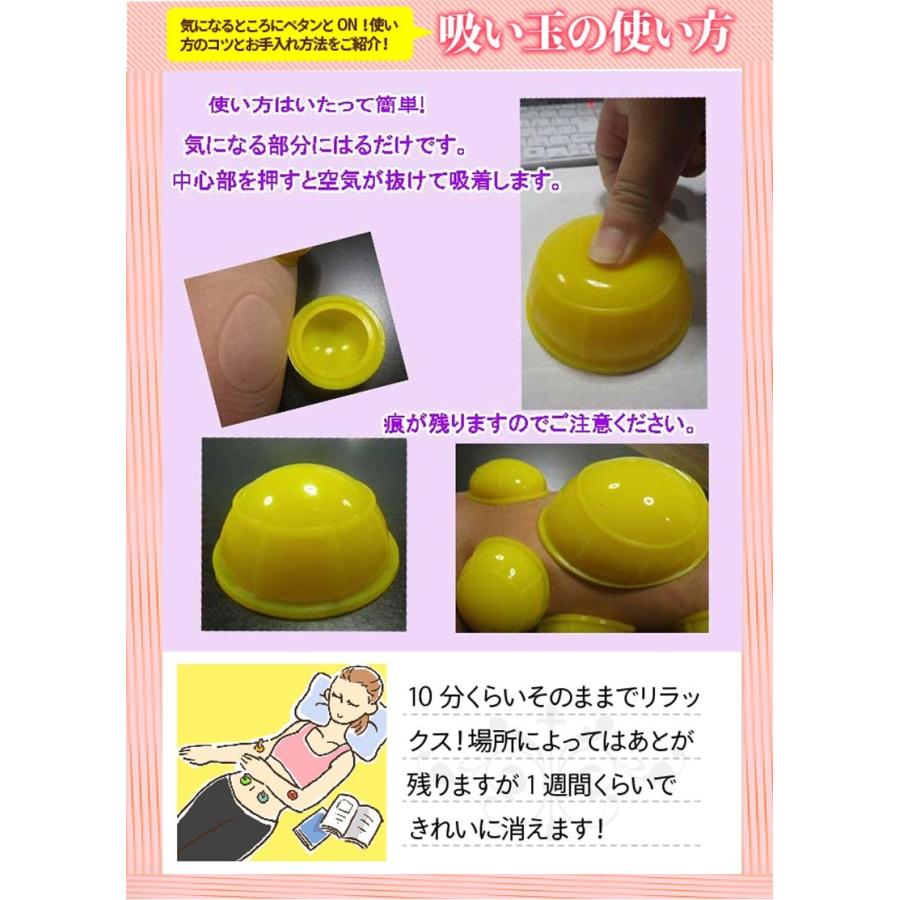 カッピング ミニ吸い玉 30個セット おまけ 磁気ハンドウォーマー