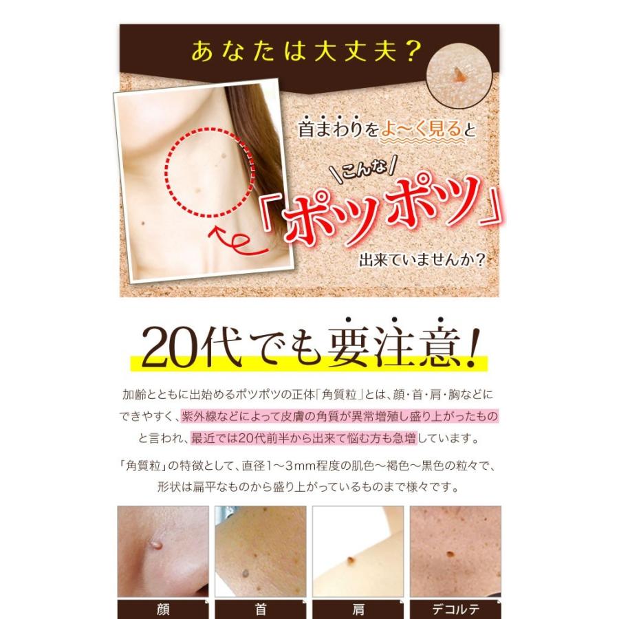 【送料無料】ポツポツ イボ 除去 自分で イボ取り お得な３本イボケアex【１８ｍｌ×３】市販薬 首 顔 胸 脇 指 のイボ｜wakuwakuten｜02