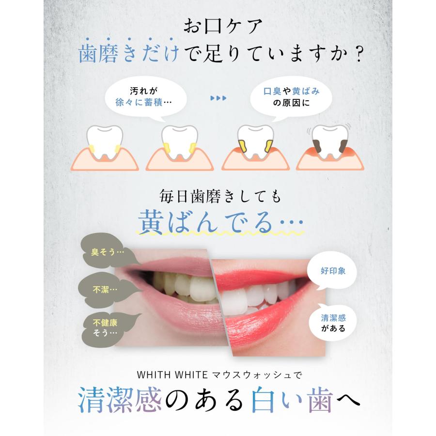 【落ちた汚れが見える】フィスホワイト ホワイトニング マウスウォッシュ 低刺激 300ml 口臭ケア 口臭清涼剤 |  | 02