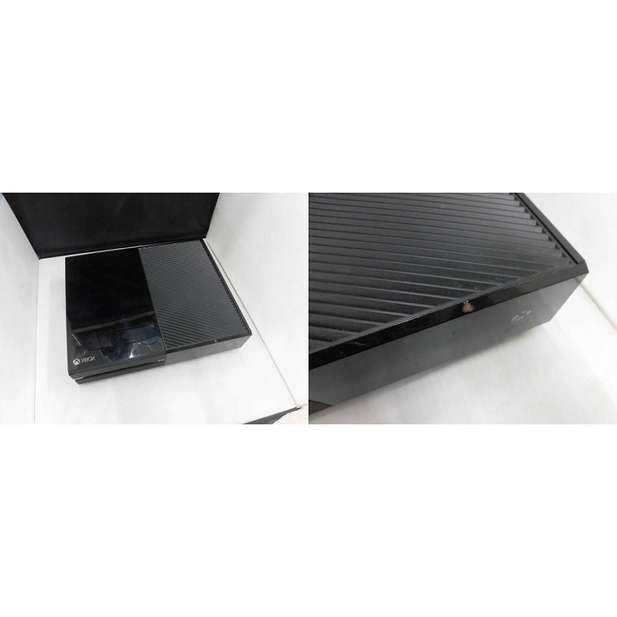 マイクロソフト Microsoft 【ジャンク】XBOX ONE 1540 : ワットマン