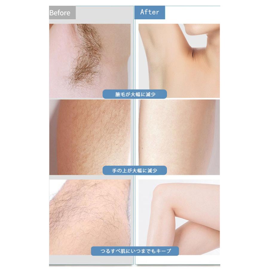 脱毛器 Ipl 脱毛 脱毛機 背中 除毛 脇毛フラッシュモード シェーバー光脱毛器 光美容器光 メンズ レディース レーザー 脱毛器 全身用 家庭用 Y008 鈴蘭美人 通販 Yahoo ショッピング