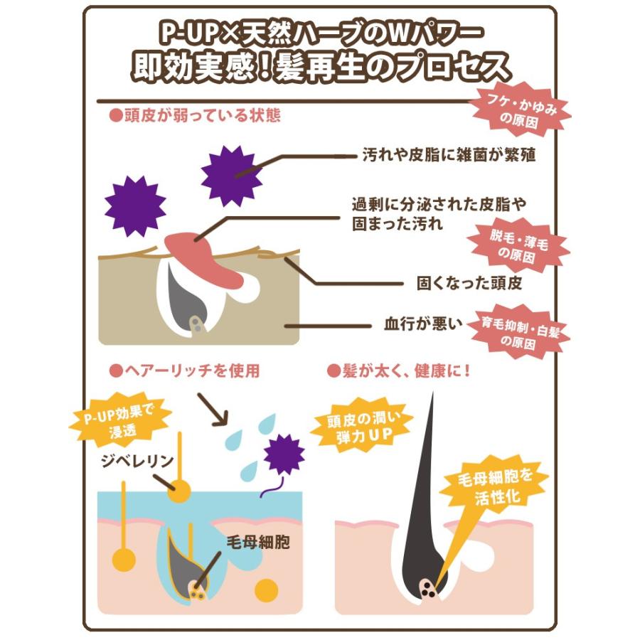 薬用育毛剤 Hair rich EX ヘアーリッチ P-UP ピーアップ 医薬部外品 