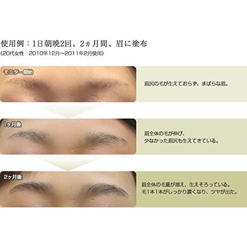 Lyuvie リューヴィ 眉毛 育毛剤 4ml 薬用 育毛 エッセンス リュービー 医薬部外品 ウェブセレクトyahoo ショップ 通販 Yahoo ショッピング