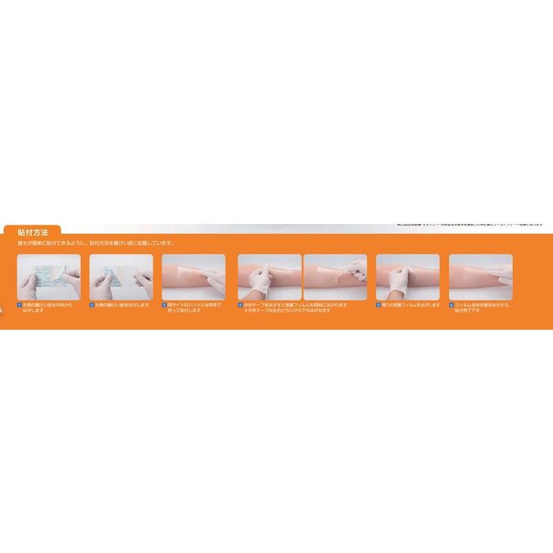 456円 激安特価品 オプサイトクイックロール 5cm×3m 1巻入 66000960 スミス アンド ネフュー 456円 激安特価品 オプサイトクイックロール 5cm×3m 1巻入 66000960 スミス アンド ネフュー