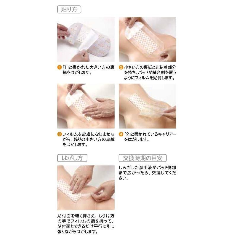 smith＆nephew（スミス・アンド・ネフュー） オプサイト POST-OP