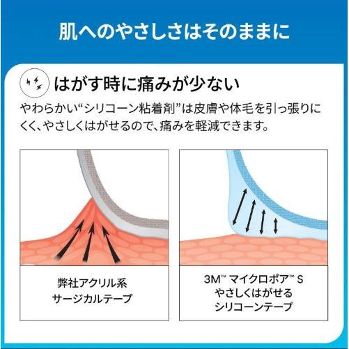 3M マイクロポアS やさしくはがせるシリコーンテープ 25mm×5m エッジ