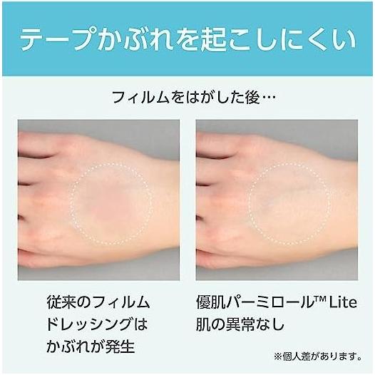 ニトムズ 優肌パーミロールLite(ハンディロールタイプ) 10cm×12m ニトムズ 優肌パーミロールLite(ハンディロールタイプ) 10cm×12m