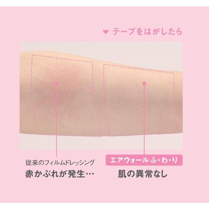skinix エアウォールふ・わ・り(未滅菌ロール状フィルム skinix エアウォールふ・わ・り(未滅菌ロール状フィルム