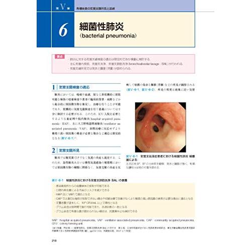 気管支鏡テキスト 第3版 : White Wings2 - 通販 - Yahoo