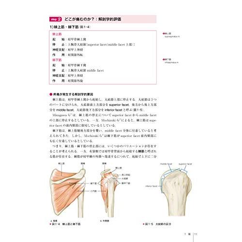 運動機能障害の「なぜ?」がわかる評価戦略 : White Wings2 - 通販