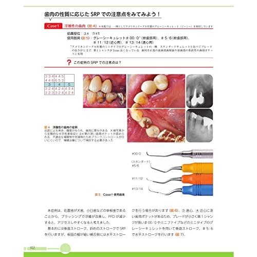 デンタルハイジーン別冊傑作選 歯周病を治すSRP できる歯科衛生 デンタルハイジーン別冊傑作選 歯周病を治すSRP できる歯科衛生