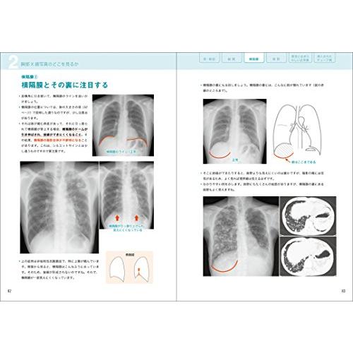 レジデントのためのやさしイイ胸部画像教室[ベストティーチャー レジデントのためのやさしイイ胸部画像教室[ベストティーチャー