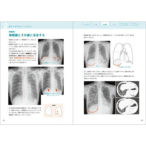 レジデントのためのやさしイイ胸部画像教室[ベストティーチャーに教わる胸部X線の読み方考え方] 改訂第2版｜white-wings2｜08