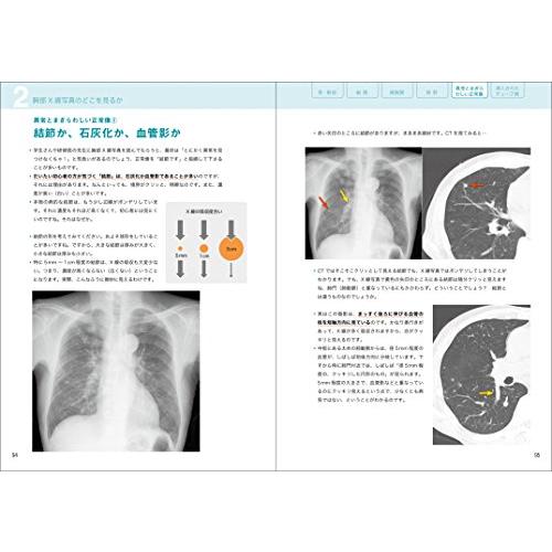 レジデントのためのやさしイイ胸部画像教室 ベストティーチャーに