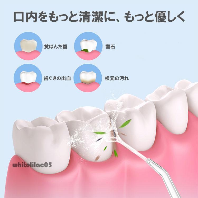 口腔洗浄器 USB充電式 マウスウォッシャー 電動 超音波 ジェット