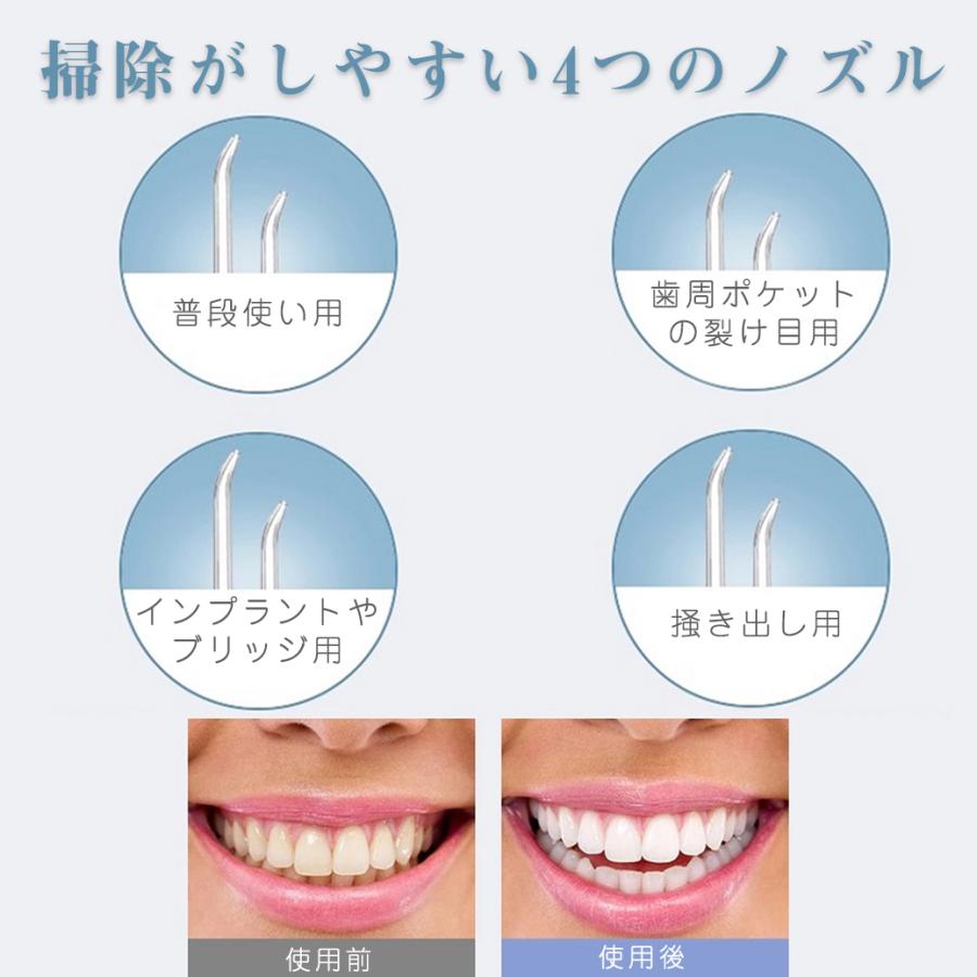 ジェットウォッシャー ホワイトニング 口腔洗浄機 口腔洗浄機 口腔ケア 歯間ブラシ ジェット水流式 150ml 防水 Usb充電 口臭予防 ホワイトニング Cws ホワイトスタートーキョー 通販 Yahoo ショッピング