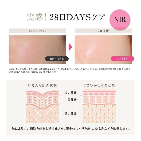 WAVEWAVE Radiant Grace 光脱毛 光美容 リフトケア 脱毛器 WAVEWAVE Radiant Grace ラディアント グレイス 光美容 艶肌