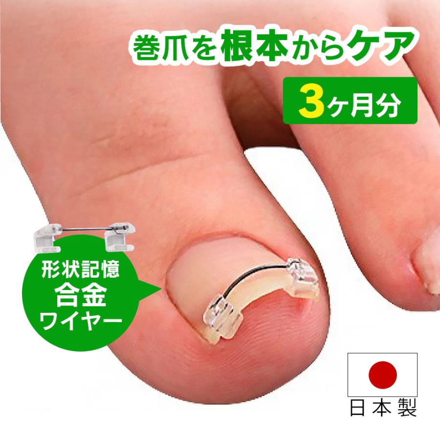 矯正器具 日本製 治し方 ワイヤーガード 3 アイデア雑貨3000点以上mono生活 治療 リフト ブロック 3箱 3ヶ月分 一般医療機器 治療 3ヶ月分 巻爪 巻き爪 治し方 矯正 テープ 自分で ポイント10倍