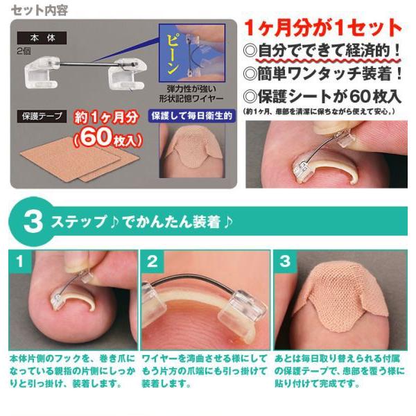 ブランド登録なし - 巻き爪 巻爪 鉄条差し固める 和らげる 組み換える 治し方 自分自身で 原則として診療用器 昇降機 差しつかえる 磁気テープ 組み換える手道具 3箱 3ヶ月分 日本製