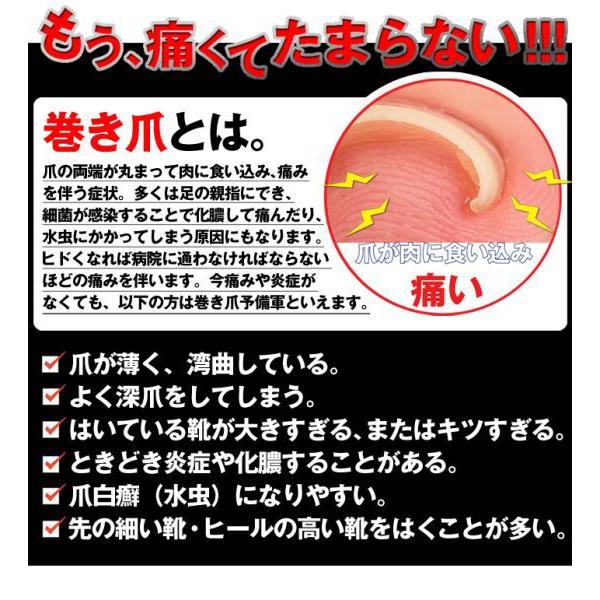 ブランド登録なし - 巻き爪 巻爪 鉄条差し固める 和らげる 組み換える 治し方 自分自身で 原則として診療用器 昇降機 差しつかえる 磁気テープ 組み換える手道具 3箱 3ヶ月分 日本製