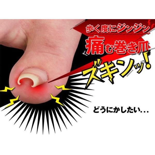 ブランド登録なし - 巻き爪 巻爪 鉄条差し固める 和らげる 組み換える 治し方 自分自身で 原則として診療用器 昇降機 差しつかえる 磁気テープ 組み換える手道具 3箱 3ヶ月分 日本製