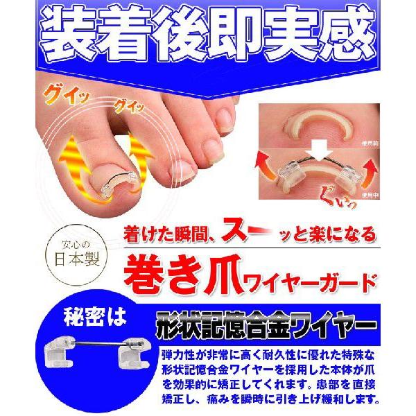 巻き爪 巻爪 ワイヤーガード 治療 矯正 治し方 自分で 一般医療機器 リフト ブロック テープ 矯正器具 1箱 1ヶ月分 日本製 | ブランド登録なし | 01