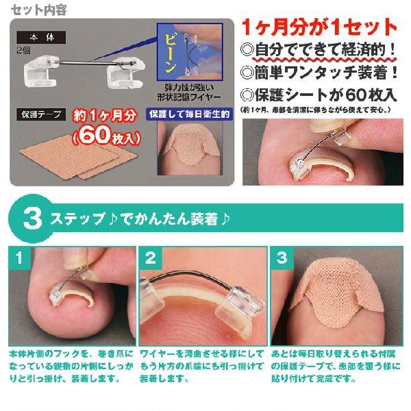 巻き爪 巻爪 ワイヤーガード 治療 矯正 治し方 自分で 一般医療機器 リフト ブロック テープ 矯正器具 1箱 1ヶ月分 日本製 | ブランド登録なし | 02