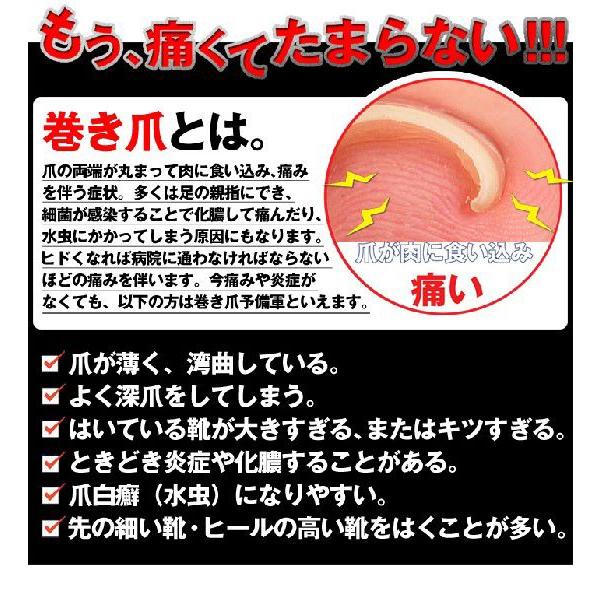 巻き爪 巻爪 ワイヤーガード 治療 矯正 治し方 自分で 一般医療機器 リフト ブロック テープ 矯正器具 1箱 1ヶ月分 日本製 | ブランド登録なし | 03