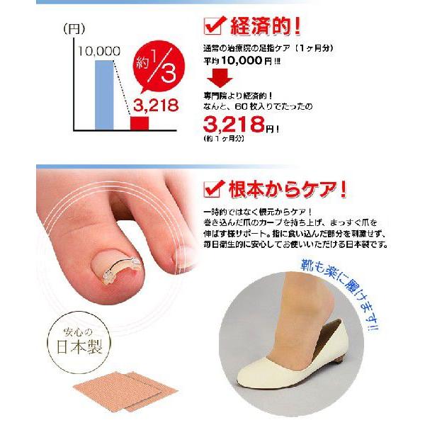 巻き爪 巻爪 ワイヤーガード 治療 矯正 治し方 自分で 一般医療機器 リフト ブロック テープ 矯正器具 1箱 1ヶ月分 日本製 | ブランド登録なし | 04