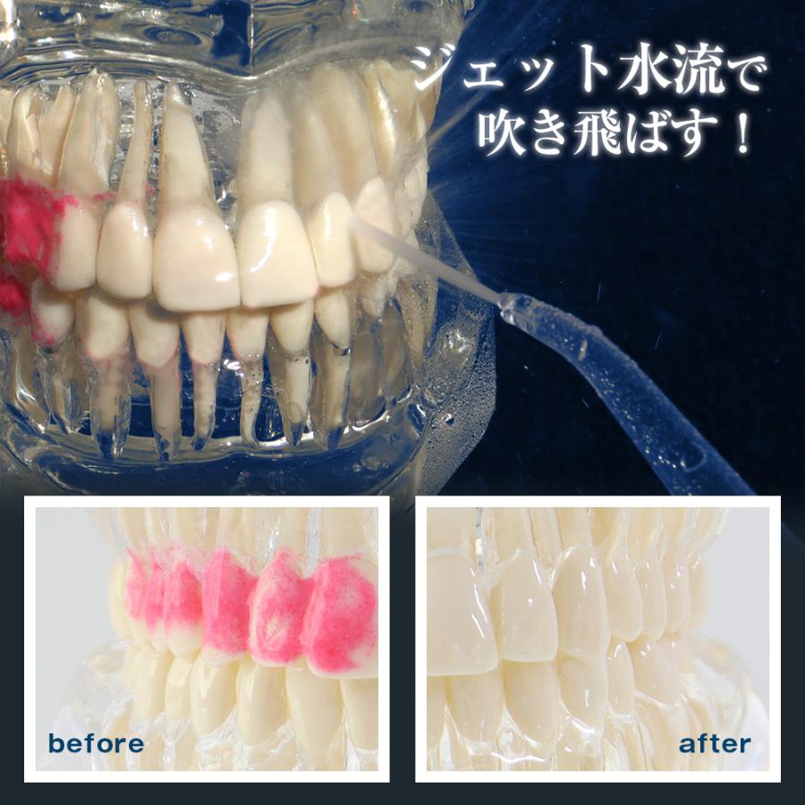 口腔洗浄器  タンクレス 小型 スリム 軽量 水流 IPX7 防水 歯間洗浄機 口内 洗浄機 風呂 コードレス ポンプ式 デンタピック | ブランド登録なし | 04