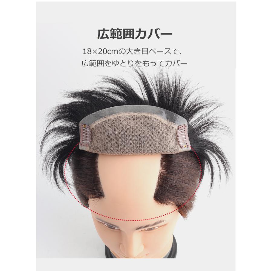 私元気 【返品交換OK！送料無料】メンズ用 人毛 総手植え トップカバー