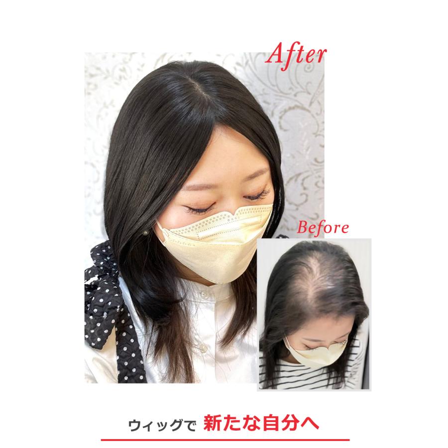 私元気 人毛風ファイバー 総手植え 【ベース大 9×14cm】広範囲カバー